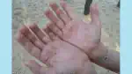 140