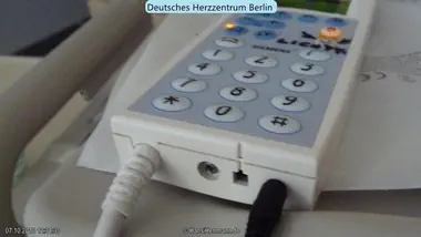 herz-op-bilder_015-mini.webp