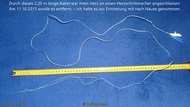 herz-op-bilder_031-mini.webp